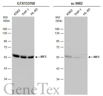 Various whole cell extracts (30 μg) were separated by 10% SDS-PAGE, and the membranes were blotted with IRF3 antibody (GTX133768) diluted at 1:1000 and competitor's antibody (sc-9082) diluted at 1:100. The HRP-conjugated anti-rabbit IgG antibody (GTX213110-01) was used to detect the primary antibody.