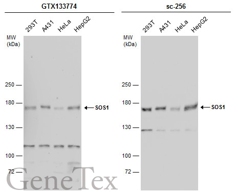 Various whole cell extracts (30 μg) were separated by 5% SDS-PAGE, and the membranes were blotted with SOS1 antibody (GTX133774) diluted at 1:1000 and competitor's antibody (sc-256) diluted at 1:1000. The HRP-conjugated anti-rabbit IgG antibody (GTX213110-01) was used to detect the primary antibody. Various whole cell extracts (30 μg) were separated by 5% SDS-PAGE, and the membranes were blotted with SOS1 antibody (GTX133774) diluted at 1:1000 and competitor's antibody (sc-256) diluted at 1:1000. The HRP-conjugated anti-rabbit IgG antibody (GTX213110-01) was used to detect the primary antibody.