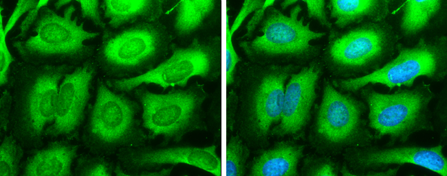 SOS1 antibody detects SOS1 protein at cytoplasm by immunofluorescent analysis. Sample: HeLa cells were fixed in 4% paraformaldehyde at RT for 15 min. Green: SOS1 stained by SOS1 antibody (GTX133774) diluted at 1:500. Blue: Hoechst 33342 staining.