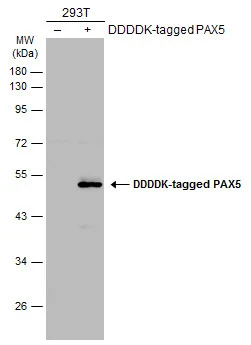 Non-transfected (–) and transfected (+) 293T whole cell extracts (30 μg) were separated by 10% SDS-PAGE, and the membrane was blotted with PAX5 antibody (GTX133777) diluted at 1:5000. The HRP-conjugated anti-rabbit IgG antibody (GTX213110-01) was used to detect the primary antibody.