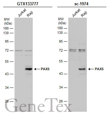 Various whole cell extracts (30 μg) were separated by 10% SDS-PAGE, and the membranes were blotted with PAX5 antibody (GTX133777) diluted at 1:1000 and competitor's antibody (sc-1974) diluted at 1:100. The HRP-conjugated anti-rabbit IgG antibody (GTX213110-01) was used to detect the primary antibody. *The competitor is not affiliated with GeneTex and does not endorse this product.