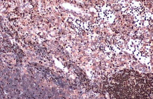 PAX5 antibody detects PAX5 protein at nucleus by immunohistochemical analysis. Sample: Paraffin-embedded rat lymph node. PAX5 stained by PAX5 antibody (GTX133777) diluted at 1:1000. Antigen Retrieval: Citrate buffer, pH 6.0, 15 min