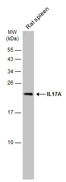 Rat tissue extract (50 μg) was separated by 15% SDS-PAGE, and the membrane was blotted with IL17A antibody (GTX133781) diluted at 1:1000. The HRP-conjugated anti-rabbit IgG antibody (GTX213110-01) was used to detect the primary antibody, and the signal was developed with Trident ECL plus-Enhanced.