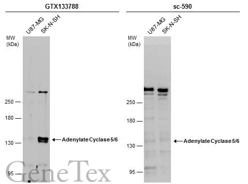 Various whole cell extracts (30 μg) were separated by 5% SDS-PAGE, and the membranes were blotted with Adenylate Cyclase 5/6 antibody (GTX133788) diluted at 1:1000 and competitor's antibody (sc-590) diluted at 1:100. The HRP-conjugated anti-rabbit IgG antibody (GTX213110-01) was used to detect the primary antibody.