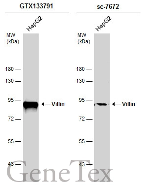 Whole cell extract (30 μg) was separated by 7.5% SDS-PAGE, and the membranes were blotted with Villin antibody (GTX133791) diluted at 1:1000 and competitor's antibody (sc-7672) diluted at 1:100. The HRP-conjugated anti-rabbit IgG antibody (GTX213110-01) was used to detect the primary antibody. Whole cell extract (30 μg) was separated by 7.5% SDS-PAGE, and the membranes were blotted with Villin antibody (GTX133791) diluted at 1:1000 and competitor's antibody (sc-7672) diluted at 1:100. The HRP-conjugated anti-rabbit IgG antibody (GTX213110-01) was used to detect the primary antibody.