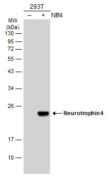 Non-transfected (–) and transfected (+) 293T whole cell extracts (30 μg) were separated by 12% SDS-PAGE, and the membrane was blotted with Neurotrophin 4 antibody (GTX133792) diluted at 1:2000. The HRP-conjugated anti-rabbit IgG antibody (GTX213110-01) was used to detect the primary antibody.