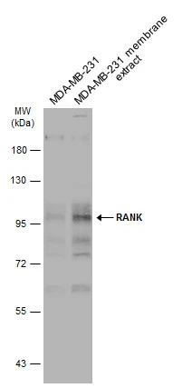 MDA-MB-231 whole cell and membrane extracts (30 μg) were separated by 7.5% SDS-PAGE, and the membrane was blotted with RANK antibody (GTX133795) diluted at 1:500. The HRP-conjugated anti-rabbit IgG antibody (GTX213110-01) was used to detect the primary antibody.