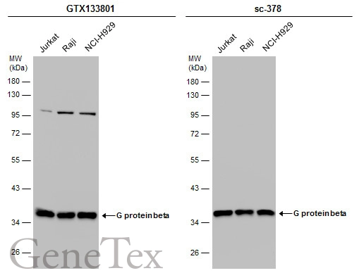 G protein beta antibody