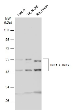 Various whole cell and tissue extracts were separated by 10% SDS-PAGE, and the membrane was blotted with JNK1 + JNK2 antibody (GTX133806) diluted at 1:1000. The HRP-conjugated anti-rabbit IgG antibody (GTX213110-01) was used to detect the primary antibody.