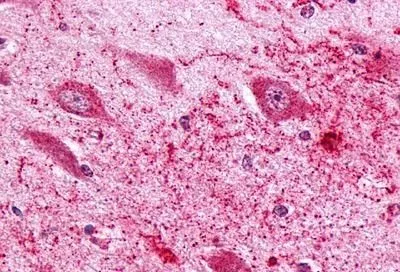 IHC-P analysis of human brain, hippocampus tissue using GTX13381 PTGER3 antibody. Antigen retrieval : Heat-induced antigen retrieval