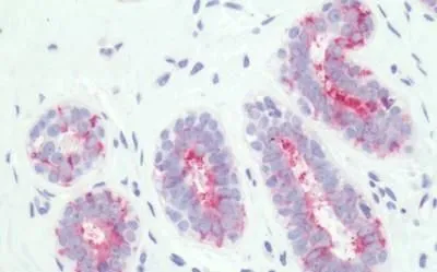 IHC-P analysis of human, breast tissue using GTX13381 PTGER3 antibody.