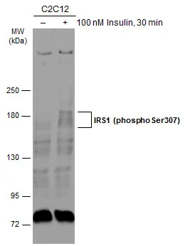 Untreated (–) and treated (+) C2C12 whole cell extracts (30 μg) were separated by 5% SDS-PAGE, and the membrane was blotted with IRS1 (phospho Ser307) antibody (GTX133848) diluted at 1:500. The HRP-conjugated anti-rabbit IgG antibody (GTX213110-01) was used to detect the primary antibody.