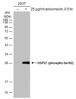 Untreated (–) and treated (+) HeLa whole cell extracts (30 μg) were separated by 12% SDS-PAGE, and the membrane was blotted with HSP27 (phospho Ser82) antibody (GTX133850) diluted at 1:1000. The HRP-conjugated anti-rabbit IgG antibody (GTX213110-01) was used to detect the primary antibody.