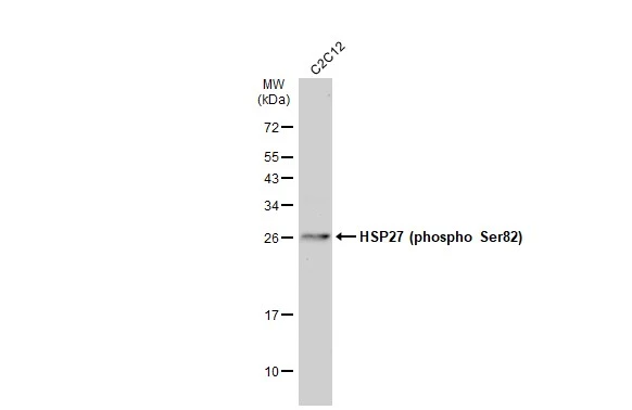 Whole cell extract (30 μg) was separated by 12% SDS-PAGE, and the membrane was blotted with HSP27 (phospho Ser82) antibody (GTX133850) diluted at 1:1000. The HRP-conjugated anti-rabbit IgG antibody (GTX213110-01) was used to detect the primary antibody, and the signal was developed with Trident ECL plus-Enhanced.