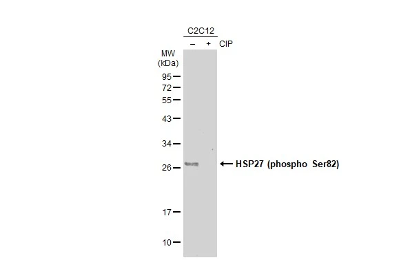 Untreated (–) and treated (+) C2C12 whole cell extracts (30 μg) were separated by 12% SDS-PAGE, and the membrane was blotted with HSP27 (phospho Ser82) antibody (GTX133850) diluted at 1:1000. The HRP-conjugated anti-rabbit IgG antibody (GTX213110-01) was used to detect the primary antibody, and the signal was developed with Trident ECL plus-Enhanced.