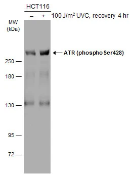 Untreated (–) and treated (+) HCT116 whole cell extracts (30 μg) were separated by 5% SDS-PAGE, and the membrane was blotted with ATR (phospho Ser428) antibody (GTX133852) diluted at 1:1000. The HRP-conjugated anti-rabbit IgG antibody (GTX213110-01) was used to detect the primary antibody.