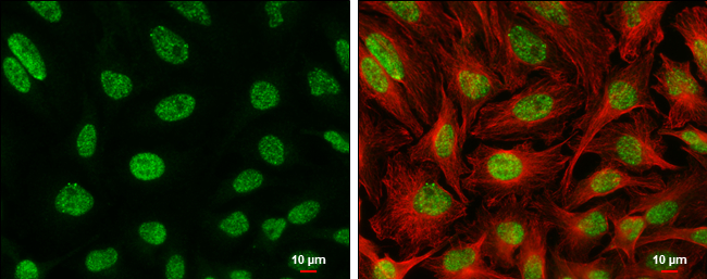 ATR (phospho Ser428) antibody detects ATR (phospho Ser428) protein at nucleus by immunofluorescent analysis. Sample: HeLa cells were fixed in 4% paraformaldehyde at RT for 15 min. Green: ATR (phospho Ser428) stained by ATR (phospho Ser428) antibody (GTX133852) diluted at 1:2000. Red: alpha Tubulin, a cytoskeleton marker, stained by alpha Tubulin antibody [GT114] (GTX628802) diluted at 1:500. Scale bar= 10 μm.