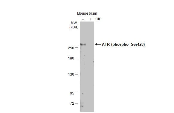 Untreated (–) and treated (+) mouse tissue extracts (50 μg) were separated by 5% SDS-PAGE, and the membrane was blotted with ATR (phospho Ser428) antibody (GTX133852) diluted at 1:1000. The HRP-conjugated anti-rabbit IgG antibody (GTX213110-01) was used to detect the primary antibody, and the signal was developed with Trident ECL plus-Enhanced.