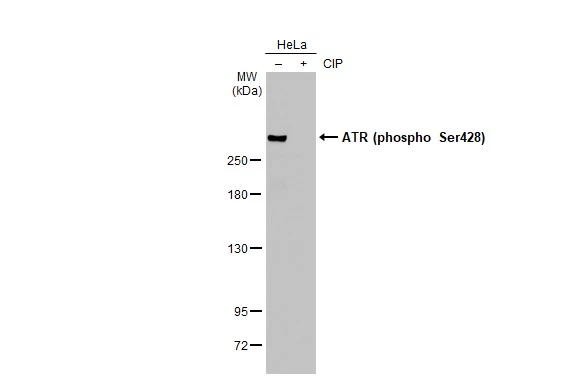 Untreated (–) and treated (+) HeLa whole cell extracts (30 μg) were separated by 5% SDS-PAGE, and the membrane was blotted with ATR (phospho Ser428) antibody (GTX133852) diluted at 1:1000. The HRP-conjugated anti-rabbit IgG antibody (GTX213110-01) was used to detect the primary antibody.