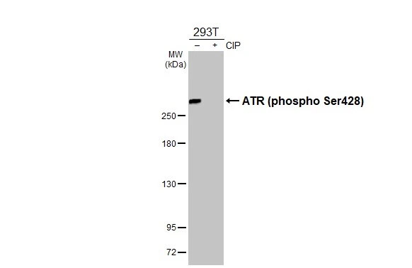Untreated (–) and treated (+) 293T whole cell extracts (30 μg) were separated by 5% SDS-PAGE, and the membrane was blotted with ATR (phospho Ser428) antibody (GTX133852) diluted at 1:1000. The HRP-conjugated anti-rabbit IgG antibody (GTX213110-01) was used to detect the primary antibody.