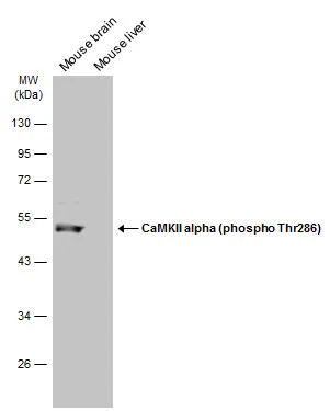 Various tissue extracts (30 μg) were separated by 10% SDS-PAGE, and the membrane was blotted with CaMKII alpha (phospho Thr286) antibody (GTX133859) diluted at 1:500. The HRP-conjugated anti-rabbit IgG antibody (GTX213110-01) was used to detect the primary antibody.