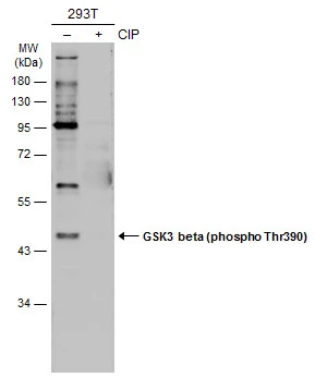 Untreated (–) and treated (+) 293T whole cell extracts (30 μg) were separated by 10% SDS-PAGE, and the membrane was blotted with GSK3 beta (phospho Thr390) antibody (GTX133870) diluted at 1:500. The HRP-conjugated anti-rabbit IgG antibody (GTX213110-01) was used to detect the primary antibody.