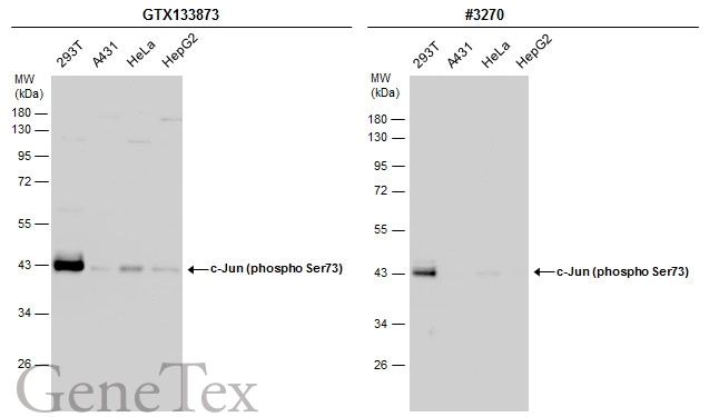 Various whole cell extracts (30 μg) were separated by 10% SDS-PAGE, and the membranes were blotted with c-Jun (phospho Ser73) antibody (GTX133873) diluted at 1:500 and competitor's antibody (CST#3270) diluted at 1:500. The HRP-conjugated anti-rabbit IgG antibody (GTX213110-01) was used to detect the primary antibody.