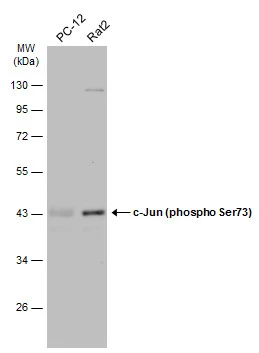 Various whole cell extracts (30 μg) were separated by 10% SDS-PAGE, and the membrane was blotted with c-Jun (phospho Ser73) antibody (GTX133873) diluted at 1:500. The HRP-conjugated anti-rabbit IgG antibody (GTX213110-01) was used to detect the primary antibody.