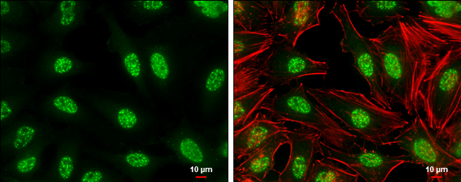 c-Jun (phospho Ser73) antibody detects c-Jun (phospho Ser73) protein at nucleus by immunofluorescent analysis. Sample: HeLa cells were fixed in 4% paraformaldehyde at RT for 15 min. Green: c-Jun (phospho Ser73) stained by c-Jun (phospho Ser73) antibody (GTX133873) diluted at 1:500. Red: phalloidin, a cytoskeleton marker, diluted at 1:100. Scale bar= 10μm.