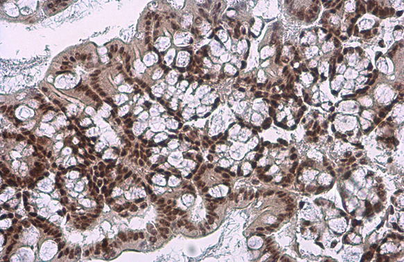 c-Jun (phospho Ser73) antibody detects c-Jun (phospho Ser73) protein at nucleus by immunohistochemical analysis. Sample: Paraffin-embedded mouse colon. c-Jun (phospho Ser73) stained by c-Jun (phospho Ser73) antibody (GTX133873) diluted at 1:500. Antigen Retrieval: Citrate buffer, pH 6.0, 15 min