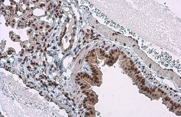 c-Jun (phospho Ser73) antibody detects c-Jun (phospho Ser73) protein at nucleus by immunohistochemical analysis. Sample: Paraffin-embedded mouse lung. c-Jun (phospho Ser73) stained by c-Jun (phospho Ser73) antibody (GTX133873) diluted at 1:500. Antigen Retrieval: Citrate buffer, pH 6.0, 15 min