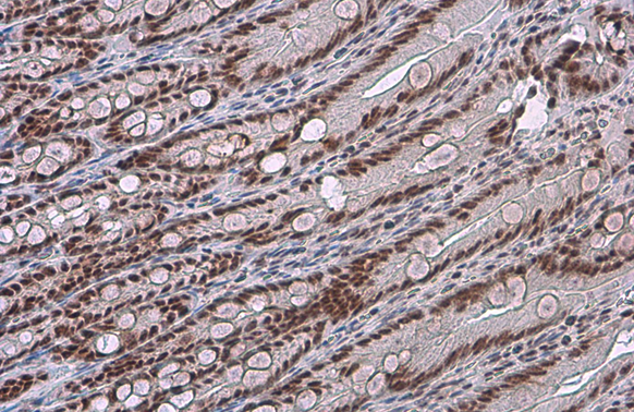 c-Jun (phospho Ser73) antibody detects c-Jun (phospho Ser73) protein at nucleus by immunohistochemical analysis. Sample: Paraffin-embedded rat duodenum. c-Jun (phospho Ser73) stained by c-Jun (phospho Ser73) antibody (GTX133873) diluted at 1:500. Antigen Retrieval: Citrate buffer, pH 6.0, 15 min