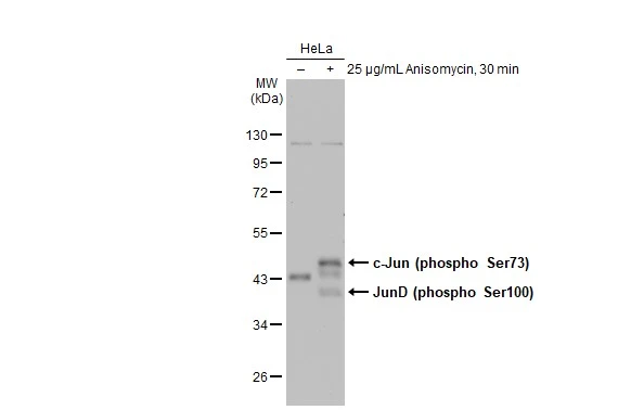 Untreated (–) and treated (+) HeLa whole cell extracts (30 μg) were separated by 10% SDS-PAGE, and the membrane was blotted with c-Jun (phospho Ser73) antibody (GTX133873) diluted at 1:500. The HRP-conjugated anti-rabbit IgG antibody (GTX213110-01) was used to detect the primary antibody.