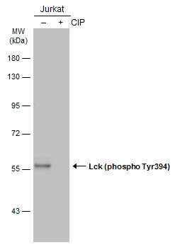 Untreated (–) and treated (+) Jurkat whole cell extracts (30 μg) were separated by 7.5% SDS-PAGE, and the membrane was blotted with Lck (phospho Tyr394) antibody (GTX133876) diluted at 1:500. The HRP-conjugated anti-rabbit IgG antibody (GTX213110-01) was used to detect the primary antibody.