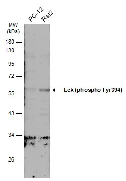 Various whole cell extracts (30 μg) were separated by 10% SDS-PAGE, and the membrane was blotted with Lck (phospho Tyr394) antibody (GTX133876) diluted at 1:500. The HRP-conjugated anti-rabbit IgG antibody (GTX213110-01) was used to detect the primary antibody.