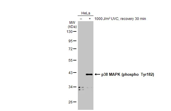 Untreated (–) and treated (+) HeLa whole cell extracts (30 μg) were separated by 10% SDS-PAGE, and the membrane was blotted with p38 MAPK (phospho Tyr182) antibody (GTX133881) diluted at 1:1000. The HRP-conjugated anti-rabbit IgG antibody (GTX213110-01) was used to detect the primary antibody.