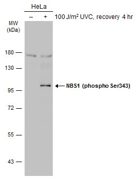 Untreated (–) and treated (+) HeLa whole cell extracts (30 μg) were separated by 7.5% SDS-PAGE, and the membrane was blotted with NBS1 (phospho Ser343) antibody (GTX133883) diluted at 1:500. The HRP-conjugated anti-rabbit IgG antibody (GTX213110-01) was used to detect the primary antibody.