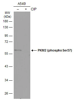 Whole cell extract (30 μg) was separated by 7.5% SDS-PAGE, and the membrane was blotted with PKM2 (phospho Ser37) antibody (GTX133886) diluted at 1:1000. The HRP-conjugated anti-rabbit IgG antibody (GTX213110-01) was used to detect the primary antibody.