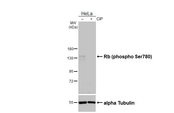 Untreated (–) and treated (+) HeLa whole cell extracts (30 μg) were separated by 7.5% SDS-PAGE, and the membrane was blotted with Rb (phospho Ser780) antibody (GTX133893) diluted at 1:1000. The HRP-conjugated anti-rabbit IgG antibody (GTX213110-01) was used to detect the primary antibody.