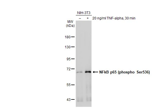 NFkB p65 (phospho Ser536) antibody
