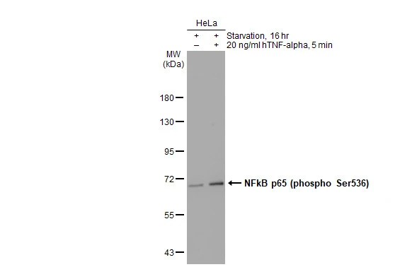 NFkB p65 (phospho Ser536) antibody