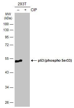 Untreated (–) and treated (+) 293T whole cell extracts (30 μg) were separated by 10% SDS-PAGE, and the membrane was blotted with p53 (phospho Ser33) antibody (GTX133902) diluted at 1:1000. The HRP-conjugated anti-rabbit IgG antibody (GTX213110-01) was used to detect the primary antibody.