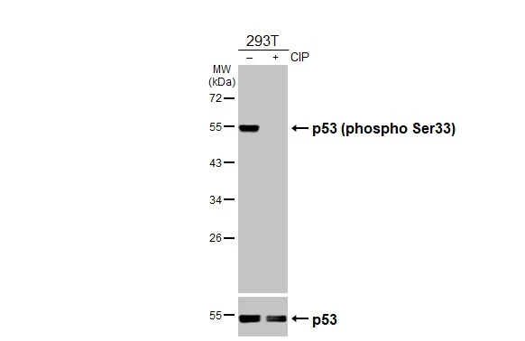 Untreated (–) and treated (+) 293T whole cell extracts (30 μg) were separated by 10% SDS-PAGE, and the membrane was blotted with p53 (phospho Ser33) antibody (GTX133902) diluted at 1:1000. The HRP-conjugated anti-rabbit IgG antibody (GTX213110-01) was used to detect the primary antibody. Untreated (–) and treated (+) 293T whole cell extracts (30 μg) were separated by 10% SDS-PAGE, and the membrane was blotted with p53 (phospho Ser33) antibody (GTX133902) diluted at 1:1000. The HRP-conjugated anti-rabbit IgG antibody (GTX213110-01) was used to detect the primary antibody.