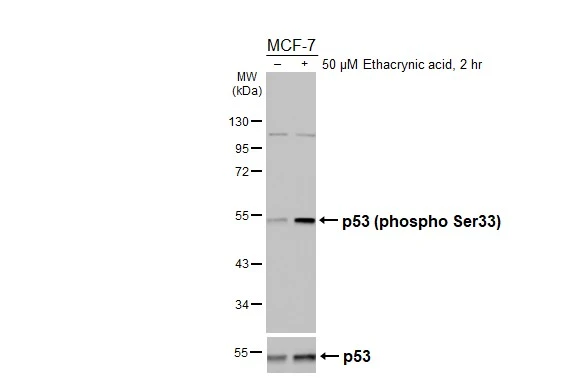 Untreated (–) and treated (+) MCF-7 whole cell extract (30 μg) were separated by 10% SDS-PAGE, and the membranes were blotted with p53 (phospho Ser33) antibody (GTX133902) diluted at 1:1000 and p53 antibody (GTX102965) diluted at 1:1000. The HRP-conjugated anti-rabbit IgG antibody (GTX213110-01) was used to detect the primary antibody, and the signal was developed with Trident ECL plus-Enhanced. Untreated (–) and treated (+) MCF-7 whole cell extract (30 μg) were separated by 10% SDS-PAGE, and the membranes were blotted with p53 (phospho Ser33) antibody (GTX133902) diluted at 1:1000 and p53 antibody (GTX102965) diluted at 1:1000. The HRP-conjugated anti-rabbit IgG antibody (GTX213110-01) was used to detect the primary antibody, and the signal was developed with Trident ECL plus-Enhanced.
