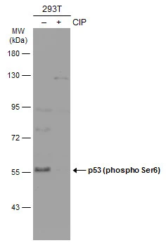 Untreated (–) and treated (+) 293T whole cell extracts (30 μg) were separated by 7.5% SDS-PAGE, and the membrane was blotted with p53 (phospho Ser6) antibody (GTX133905) diluted at 1:500. The HRP-conjugated anti-rabbit IgG antibody (GTX213110-01) was used to detect the primary antibody. Untreated (–) and treated (+) 293T whole cell extracts (30 μg) were separated by 7.5% SDS-PAGE, and the membrane was blotted with p53 (phospho Ser6) antibody (GTX133905) diluted at 1:500. The HRP-conjugated anti-rabbit IgG antibody (GTX213110-01) was used to detect the primary antibody.