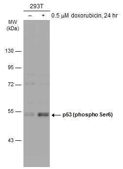 Untreated (–) and treated (+) 293T whole cell extracts (30 μg) were separated by 7.5% SDS-PAGE, and the membrane was blotted with p53 (phospho Ser6) antibody (GTX133905) diluted at 1:1000. The HRP-conjugated anti-rabbit IgG antibody (GTX213110-01) was used to detect the primary antibody.