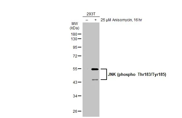 Untreated (–) and treated (+) 293T whole cell extracts (30 μg) were separated by 10% SDS-PAGE, and the membrane was blotted with JNK (phospho Thr183/Tyr185) antibody (GTX133934) diluted at 1:1000. The HRP-conjugated anti-rabbit IgG antibody (GTX213110-01) was used to detect the primary antibody, and the signal was developed with Trident ECL plus-Enhanced. Untreated (–) and treated (+) 293T whole cell extracts (30 μg) were separated by 10% SDS-PAGE, and the membrane was blotted with JNK (phospho Thr183/Tyr185) antibody (GTX133934) diluted at 1:1000. The HRP-conjugated anti-rabbit IgG antibody (GTX213110-01) was used to detect the primary antibody, and the signal was developed with Trident ECL plus-Enhanced.