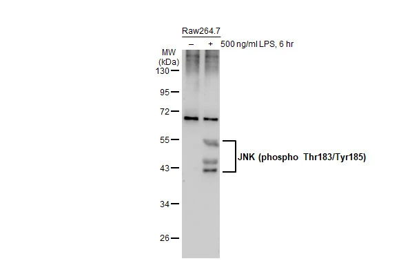 Untreated (–) and treated (+) Raw264.7 whole cell extracts (30 μg) were separated by 10% SDS-PAGE, and the membrane was blotted with JNK (phospho Thr183/Tyr185) antibody (GTX133934) diluted at 1:1000. The HRP-conjugated anti-rabbit IgG antibody (GTX213110-01) was used to detect the primary antibody, and the signal was developed with Trident ECL plus-Enhanced. Untreated (–) and treated (+) Raw264.7 whole cell extracts (30 μg) were separated by 10% SDS-PAGE, and the membrane was blotted with JNK (phospho Thr183/Tyr185) antibody (GTX133934) diluted at 1:1000. The HRP-conjugated anti-rabbit IgG antibody (GTX213110-01) was used to detect the primary antibody, and the signal was developed with Trident ECL plus-Enhanced.