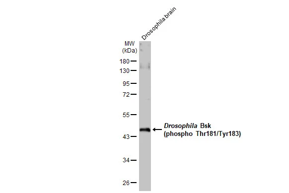 Drosophila tissue extract (50 μg) was separated by 10% SDS-PAGE, and the membrane was blotted with JNK (phospho Thr183/Tyr185) antibody (GTX133934) diluted at 1:1000. The HRP-conjugated anti-rabbit IgG antibody (GTX213110-01) was used to detect the primary antibody, and the signal was developed with Trident ECL plus-Enhanced.
