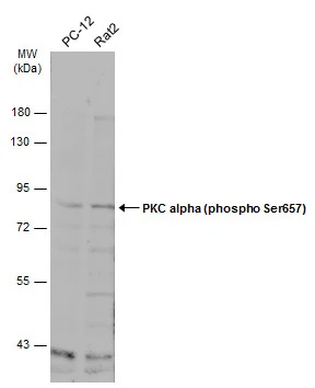 Various whole cell extracts (30 μg) were separated by 7.5% SDS-PAGE, and the membrane was blotted with PKC alpha (phospho Ser657) antibody (GTX133936) diluted at 1:500. The HRP-conjugated anti-rabbit IgG antibody (GTX213110-01) was used to detect the primary antibody.